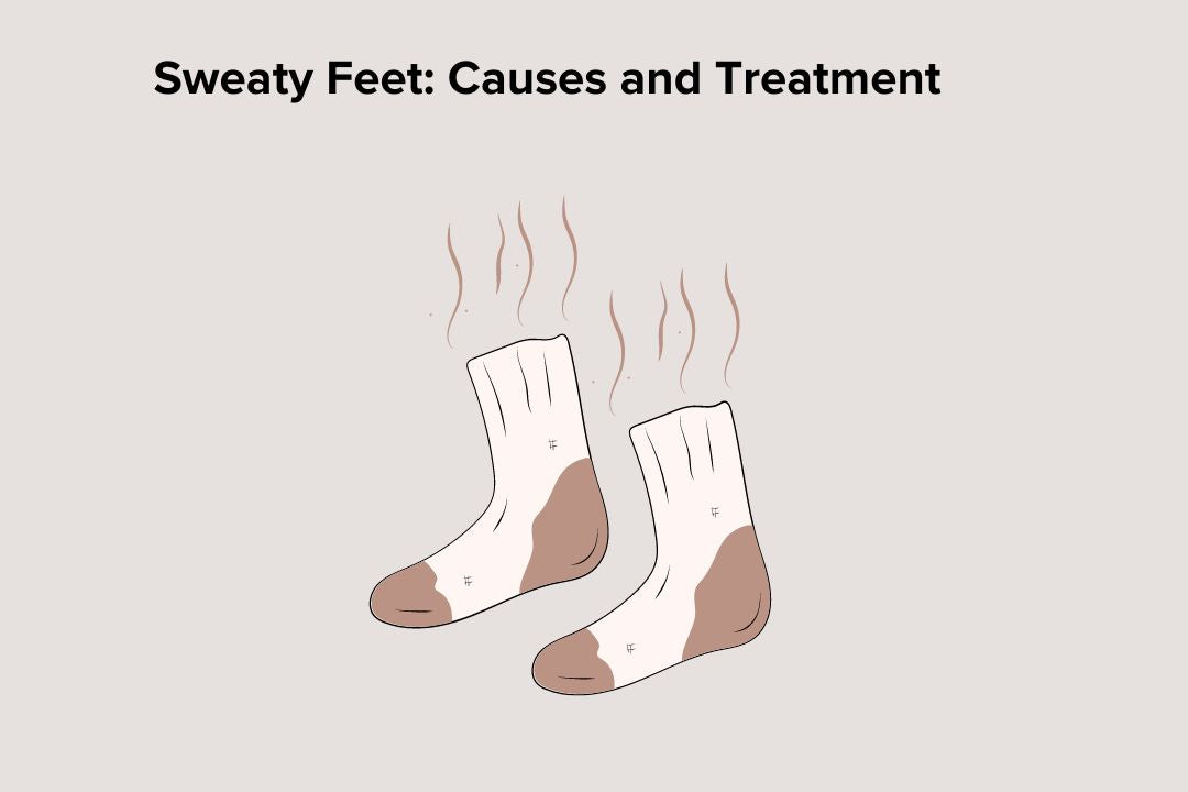 sweaty feet causes 